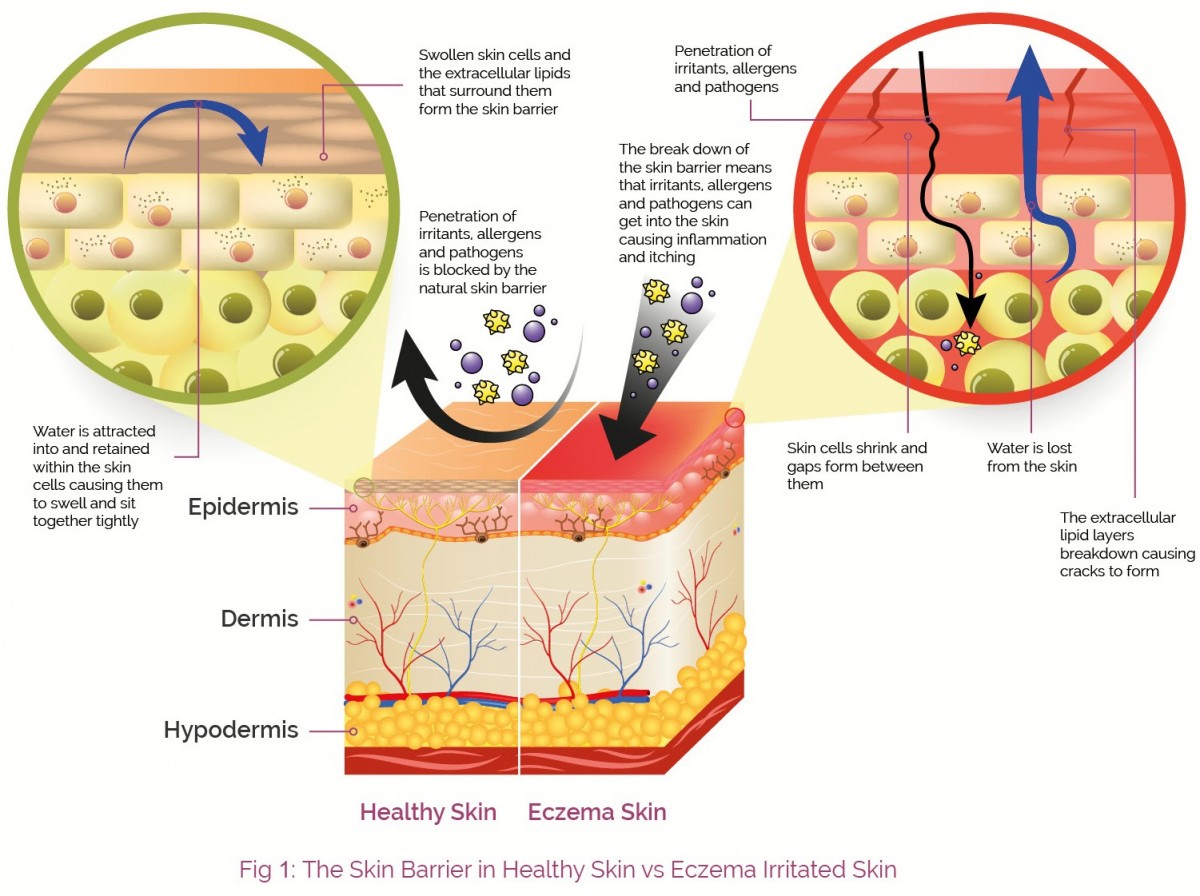 2016_June_AproDerm_Consumer_Website_The_Skin_Barrier_Fig_1 2016_June_AproDerm_Consumer_Website_The_Skin_Barrier_Fig_1