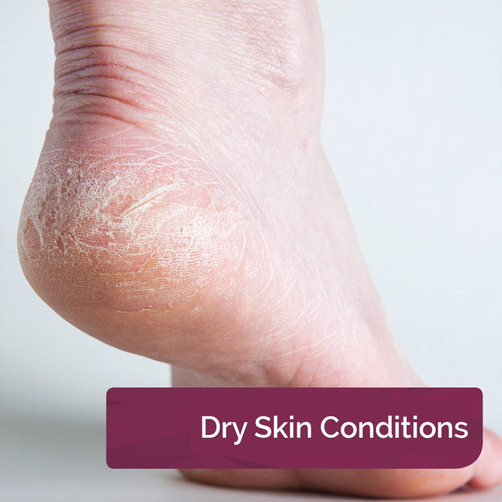 Dry Skin Conditions
